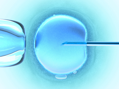 Artificial Insemination (In vitro fecundation using sperm)